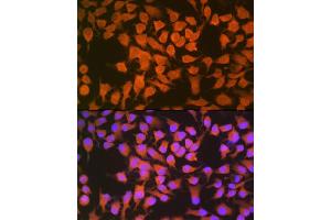 Immunofluorescence analysis of HeLa cells using CBS Rabbit mAb (ABIN7266615) at dilution of 1:100 (40x lens). (CBS 抗体)
