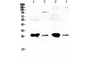 Western blot analysis of GSTT1 using anti-GSTT1 antibody . (GSTT1 抗体  (AA 3-231))