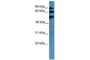 WB Suggested Anti-BBS2 Antibody Titration: 0. (BBS2 抗体  (Middle Region))