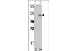 Western blot analysis of AURKB (arrow) using rabbit polyclonal Aurora-B (ARK/STK12) Antibody (Center) (ABIN391354 and ABIN2841375). (Aurora-B (ARK/STK12) (AA 283-313) 抗体)