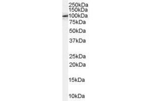 Western Blotting (WB) image for anti-Amyloid beta (A4) Precursor Protein-Binding, Family B, Member 1 (Fe65) (APBB1) (C-Term) antibody (ABIN2465409) (FE65 抗体  (C-Term))