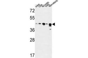 Western Blotting (WB) image for anti-Alcohol Dehydrogenase 7 (Class IV), mu Or sigma Polypeptide (ADH7) antibody (ABIN3004285)