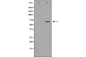 Western blot analysis of K562 whole cell lysates, using PIAS2 Antibody.