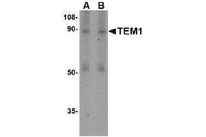 Image no. 1 for anti-CD248 Molecule, Endosialin (CD248) (N-Term) antibody (ABIN1494342) (CD248 抗体  (N-Term))