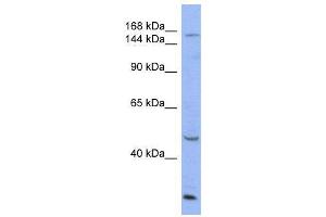 WB Suggested Anti-ATP7A  Antibody Titration: 0. (ATP7A 抗体  (Middle Region))