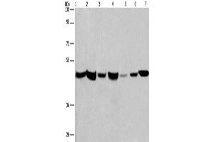 Western Blotting (WB) image for anti-Adipocyte Plasma Membrane Associated Protein (APMAP) antibody (ABIN2431985) (APMAP 抗体)