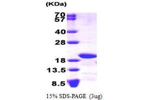 SDS-PAGE (SDS) image for NADH Dehydrogenase (Ubiquinone) Fe-S Protein 4, 18kDa (NADH-Coenzyme Q Reductase) (NDUFS4) (AA 43-175) protein (ABIN667110) (NDUFS4 Protein (AA 43-175))