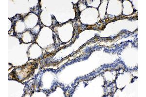 Immunohistochemistry (IHC) image for anti-Protein Phosphatase 1, Regulatory (Inhibitor) Subunit 14A (PPP1R14A) (AA 30-126) antibody (ABIN5518865)