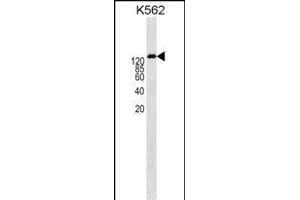 ABCB1 Antibody  (ABIN1538560 and ABIN2840587) western blot analysis in K562 cell line lysates (35 μg/lane). (ABCB1 抗体  (AA 647-677))