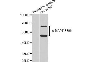 Western Blotting (WB) image for anti-Microtubule-Associated Protein tau (MAPT) (pSer396) antibody (ABIN1870397) (MAPT 抗体  (pSer396))