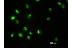 Immunofluorescence (IF) image for anti-Signal Transducer and Activator of Transcription 5B (STAT5B) (AA 1-390) antibody (ABIN563035)