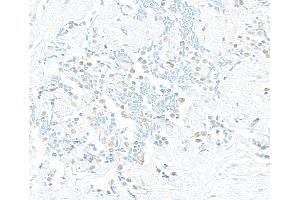 Immunohistochemistry (IHC) image for anti-PDS5, Regulator of Cohesion Maintenance, Homolog B (PDS5B) (C-Term) antibody (ABIN7453755)