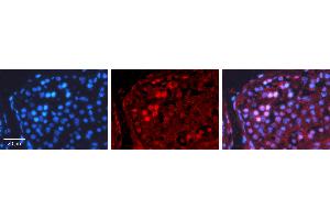 Rabbit Anti-CREB1 Antibody Catalog Number: ARP31264_T100 Formalin Fixed Paraffin Embedded Tissue: Human Testis Tissue Observed Staining: Nucleus Primary Antibody Concentration: 1:100 Other Working Concentrations: N/A Secondary Antibody: Donkey anti-Rabbit-Cy3 Secondary Antibody Concentration: 1:200 Magnification: 20X Exposure Time: 0. (CREB1 抗体  (N-Term))