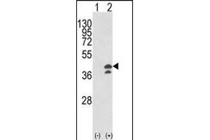 Western blot analysis of GOT1 (arrow) using rabbit polyclonal GOT1 Antibody (N-term) (ABIN650769 and ABIN2839550). (GOT1 抗体  (N-Term))