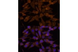 Immunofluorescence analysis of HeLa cells using UGT2B7 Polyclonal Antibody (ABIN6132908, ABIN6149903, ABIN6149904 and ABIN6218790) at dilution of 1:100 (40x lens). (UGT2B7 抗体  (AA 25-351))