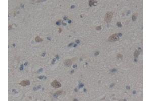 Immunohistochemistry (IHC) image for anti-Growth Differentiation Factor 2 (GDF2) (AA 32-427) antibody (ABIN7442522)