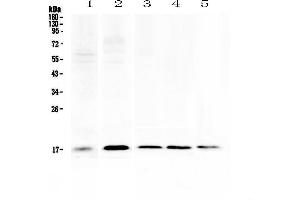 Western blot analysis of Psoriasin using anti-Psoriasin antibody . (S100A7 抗体  (AA 2-101))