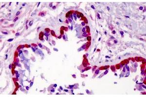 Human Lung: Formalin-Fixed, Paraffin-Embedded (FFPE) (METTL7A 抗体  (Internal Region))
