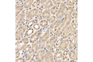 Immunohistochemistry (IHC) image for anti-Solute Carrier Family 14 (Urea Transporter), Member 1 (Kidd Blood Group) (SLC14A1) (C-Term) antibody (ABIN7270402)