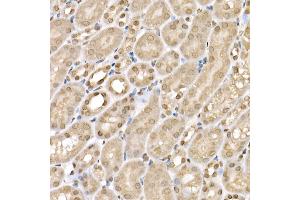 Immunohistochemistry of paraffin-embedded mouse kidney using SLC14 Rabbit pAb (5991) at dilution of 1:200 (40x lens). (SLC14A1 抗体  (C-Term))