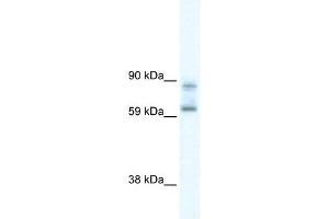 DDX42 antibody used at 5 ug/ml to detect target protein. (DDX42 抗体)