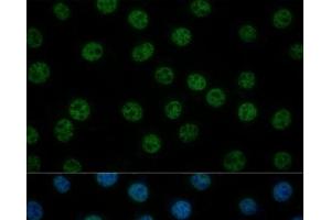 Immunofluorescence analysis of L929 cells using GTF2B Polyclonal Antibody at dilution of 1:100 (40x lens). (GTF2B 抗体)