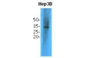 Western Blotting (WB) image for anti-Thiopurine S-Methyltransferase (TPMT) antibody (ABIN781549) (TPMT 抗体)