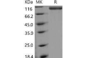 Selectin E (SELE) (Active) protein (Fc Tag)