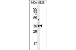 Western blot analysis in MDA-MB231 cell line lysates (35ug/lane). (TPSD1 抗体  (C-Term))