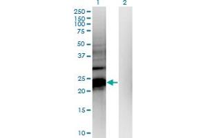Western Blot analysis of HDHD1A expression in transfected 293T cell line by HDHD1A monoclonal antibody (M05), clone 4F12. (HDHD1 抗体  (AA 107-212))
