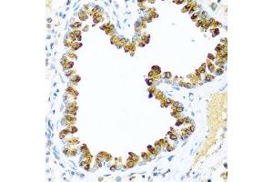 Immunohistochemistry of paraffin-embedded mouse lung using NRG4 antibody at dilution of 1:100 (40x lens). (Neuregulin 4 抗体)