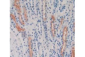 Used in DAB staining on fromalin fixed paraffin- embedded Kidney tissue (LPHN2 抗体  (AA 139-398))