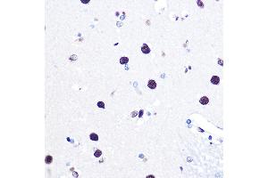 Immunohistochemistry of paraffin-embedded human brain using hnRNP C Rabbit pAb (ABIN7267630) at dilution of 1:100 (40x lens). (HNRNPC 抗体)