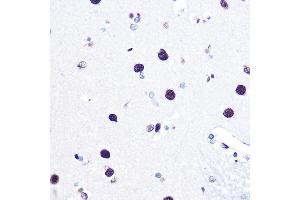 Immunohistochemistry of paraffin-embedded human brain using hnRNP C Rabbit pAb (ABIN7267630) at dilution of 1:100 (40x lens).