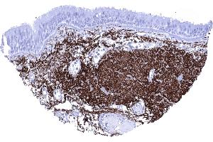 Bronchus mucosa High content of elastin fibres along the bronchus mucosa (Recombinant Elastin 抗体)