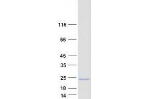Calcium Regulated Heat Stable Protein 1, 24kDa (CARHSP1) (Transcript Variant 2) protein (Myc-DYKDDDDK Tag)