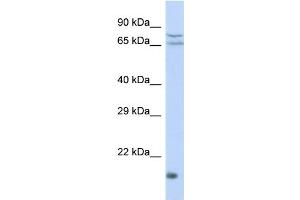 Host: Rabbit Target Name: ZNF195 Sample Type: HepG2 Whole cell lysates Antibody Dilution: 1. (ZNF195 抗体  (N-Term))