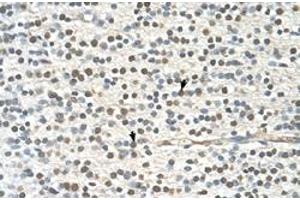 Immunohistochemical staining (Formalin-fixed paraffin-embedded sections) of human brain with GAPVD1 polyclonal antibody  at 4-8 ug/mL working concentration. (GAPVD1 抗体  (N-Term))