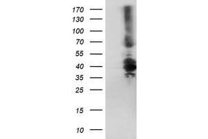 HEK293T cells were transfected with the pCMV6-ENTRY control (Left lane) or pCMV6-ENTRY DTNB (Right lane) cDNA for 48 hrs and lysed. (Dystrobrevin beta 抗体)