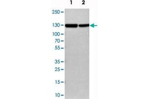 Western blot analysis of cell lysates with CFB polyclonal antibody . (Complement Factor B 抗体)