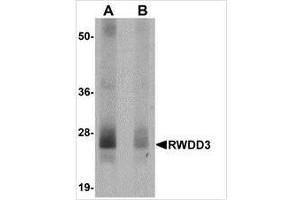 Western blot analysis of RWDD3 in mouse kidney tissue lysate with RWDD3 antibody at 0. (RWDD3 抗体  (N-Term))