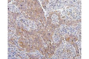 IHC analysis of CDK1 using anti-CDK1 antibody (ABIN7602240). (CDK1 抗体  (AA 66-297))
