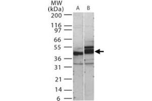 Western blot analysis of human SIGIRR in 15 ugs of (A) human kidney and (B) mouse kidney cell lysate. (SIGIRR 抗体  (AA 334-358))
