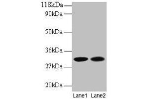 Western blot All lanes: MRPL9 antibody at 2 μg/mL Lane 1: EC109 whole cell lysate Lane 2: 293T whole cell lysate Secondary Goat polyclonal to rabbit IgG at 1/15000 dilution Predicted band size: 31 kDa Observed band size: 31 kDa (MRPL9 抗体  (AA 60-267))