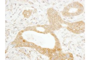 anti-Tankyrase, TRF1-Interacting Ankyrin-Related ADP-Ribose Polymerase (TNKS) (AA 1277-1327) antibody