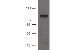 Image no. 1 for anti-Desmoglein 2 (DSG2) (AA 37-164) antibody (ABIN1169682) (Desmoglein 2 抗体  (AA 37-164))