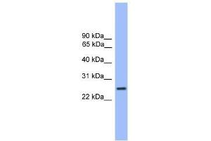 Western Blot showing GOSR1 antibody used at a concentration of 1-2 ug/ml to detect its target protein. (GS28 抗体  (C-Term))