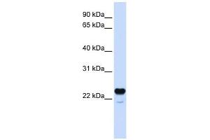 C1QTNF1 antibody used at 1 ug/ml to detect target protein. (C1QTNF1 抗体  (N-Term))