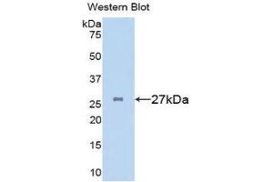Western Blotting (WB) image for anti-Clusterin (CLU) (AA 227-447) antibody (ABIN1077939) (Clusterin 抗体  (AA 227-447))