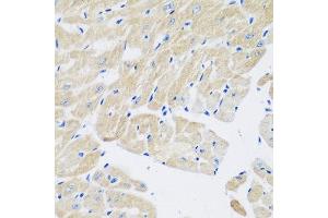 Immunohistochemistry of paraffin-embedded mouse heart using TGM5 antibody at dilution of 1:200 (40x lens). (Transglutaminase 5 抗体)